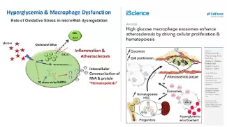 raffi-hyperglycemia-macrophages